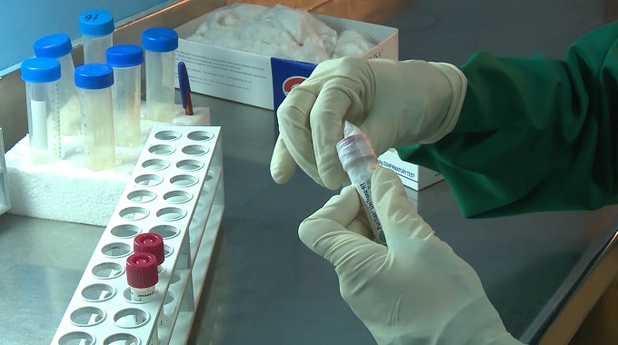 Reportan dos nuevos casos de Covid_19 en Las Tunas