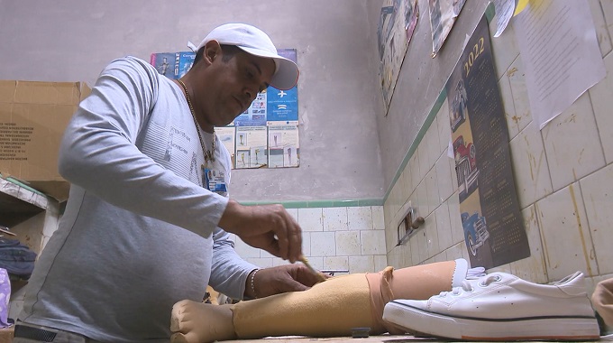 Mantienen en Las Tunas atención a pacientes con afecciones ortopédicas
