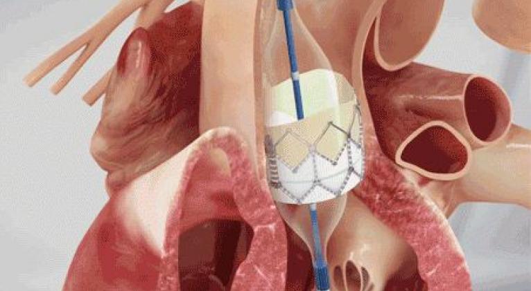 Proceder quirúrgico en Cuba trae esperanza de vida a pacientes (+ VIDEO)