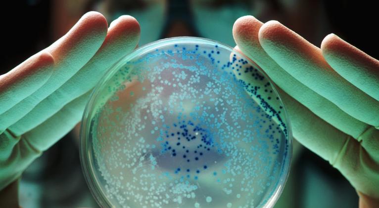 OMS advierte de una "pandemia silenciosa" causada por bacterias resistentes