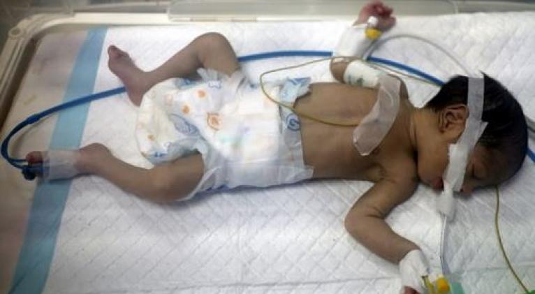 La ONU acusa a Israel de "actos genocidas" por ataques a la salud reproductiva en Gaza
