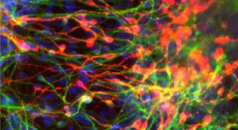 El cerebro es capaz de autorrepararse