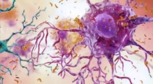 Una variante genética aliada del cerebro contra el Alzheimer
