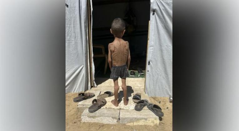 Al menos dos gazatíes, entre ellas un niño, murieron por causas relacionadas con la desnutrición y la hambruna, según un recuento publicado este miércoles por el Ministerio de Sanidad; lo que aumentó a 455 los fallecidos desde octubre de 2023. Entre los fallecidos por esta causa hay también 151 niños, incluidos bebés de solo meses o pocos años de vida. Desde el pasado 22 de agosto, cuando un organismo internacional avalado por la ONU declaró oficialmente la existencia de una hambruna en la ciudad de Gaza y áreas aledañas, se han contabilizado 177 muertes por desnutrición, entre ellas 36 menores, de acuerdo con Sanidad. El informe publicado por la CIF indica que un total de 1,6 millones de gazatíes sufren hambre, entre ellos una tercera parte (más de 640.000) de manera crítica, al padecer de una privación extrema de alimentos, mientras que el resto de la población se encuentra en situación de "crisis alimentaria". Israel no permite la entrada masiva de ayuda humanitaria de camiones de la ONU desde hace más de seis meses -alegando que Hamás se beneficia de estos suministros-, e implementó un sistema de reparto de alimento a través de unos complejos militarizados, la mayoría en el sur del enclave, obligando a la población a desplazarse hasta ellos. Casi a diario, las tropas israelíes han abierto fuego cerca de estos puntos a fin de dispersar a las miles de personas que acudían en busca de algo de comida. Según Sanidad, unos 2.500 palestinos han sido asesinados en sus alrededores o cerca de los puestos de control militares por donde pasan los escasos camiones que Israel sí deja entrar. A todo ello se suma la escasez de recursos hospitalarios para atender a pacientes de desnutrición, en medio de los bombardeos y las constantes órdenes de desplazamiento mientras prosigue la ofensiva israelí en la Franja.
