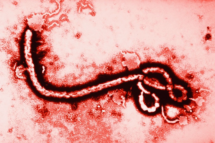 Médico de EE.UU. positivo a virus del Ébola en la República Democrática del Congo